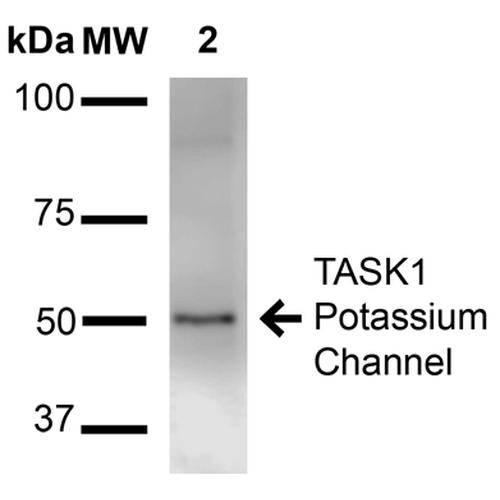Western Blot analysis of Rat Brain Membrane showing detection of ~50 kDa TASK1 Potassium Channel protein using Mouse Anti-TASK1 Potassium Channel Monoclonal Antibody, Clone N374/48 (STMA00160). Lane 1: Molecular Weight Ladder (MW). Lane 2: Rat brain membrane. Load: 15 µg. Block: 2% BSA and 2% Skim Milk in 1X TBST. Primary Antibody: Mouse Anti-TASK1 Potassium Channel Monoclonal Antibody (STMA00160) at 1:1000 for 16 hours at 4°C.