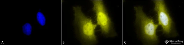 Immunocytochemistry/Immunofluorescence analysis using Rat Anti-HSF1 Monoclonal Antibody, Clone 4B4 (STMA00163). Tissue: Heat Shocked cervical cancer cells (HeLa). Species: Human. Fixation: 2% Formaldehyde for 20 min at RT. Primary Antibody: Rat Anti-HSF1 Monoclonal Antibody (STMA00163) at 1:100 for 12 hours at 4°C. Secondary Antibody: R-PE Goat Anti-Rat (yellow) at 1:200 for 2 hours at RT.