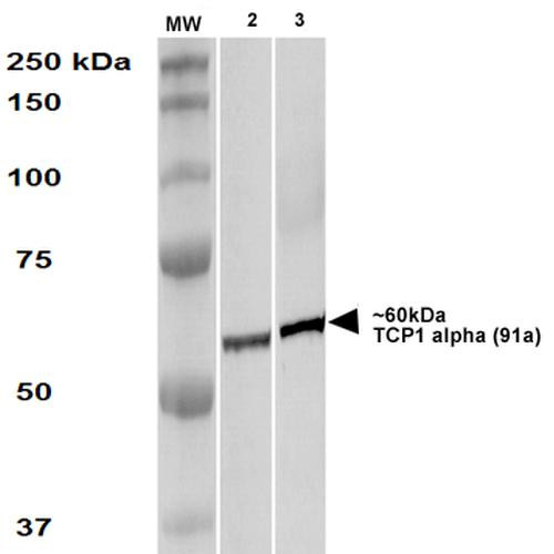 Western Blot analysis of Human A431 and HEK293 cell lysates showing detection of TCP1 alpha protein using Rat Anti-TCP1 alpha Monoclonal Antibody, Clone 91a (STMA00164). Primary Antibody: Rat Anti-TCP1 alpha Monoclonal Antibody (STMA00164) at 1:1000.