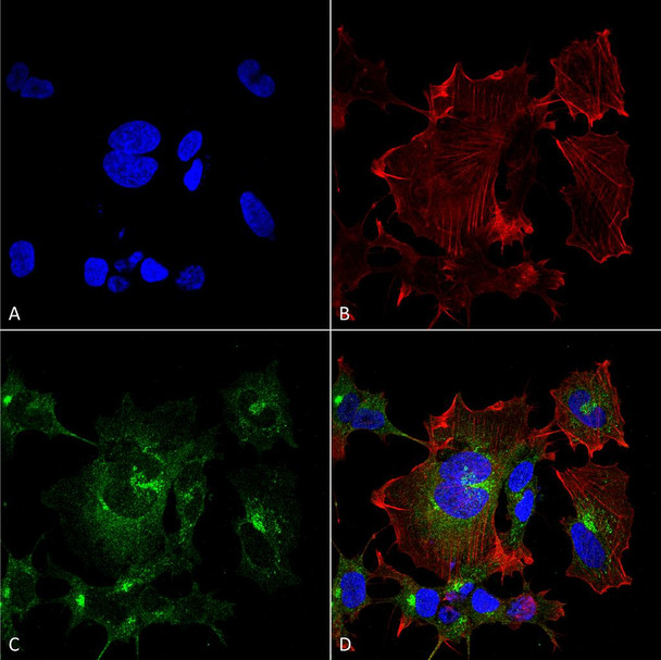 Immunocytochemistry/Immunofluorescence analysis using Mouse Anti-NPAS4 Monoclonal Antibody, Clone N408/79 (STMA00172). Tissue: Neuroblastoma cell line (SK-N-BE). Species: Human. Fixation: 4% Formaldehyde for 15 min at RT. Primary Antibody: Mouse Anti-NPAS4 Monoclonal Antibody (STMA00172) at 1:100 for 60 min at RT. Secondary Antibody: Goat Anti-Mouse ATTO 488 at 1:100 for 60 min at RT.