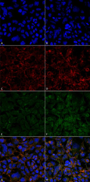 Immunocytochemistry/Immunofluorescence analysis using Mouse Anti-Hexanoyl-Lysine adduct Monoclonal Antibody, Clone 5E8 (STMA00180). Tissue: Embryonic kidney epithelial cell line (HEK293). Species: Human. Fixation: 5% Formaldehyde for 5 min. Primary Antibody: Mouse Anti-Hexanoyl-Lysine adduct Monoclonal Antibody (STMA00180) at 1:50 for 30-60 min at RT. Secondary Antibody: Goat Anti-Mouse Alexa Fluor 488 at 1:1500 for 30-60 min at RT.
