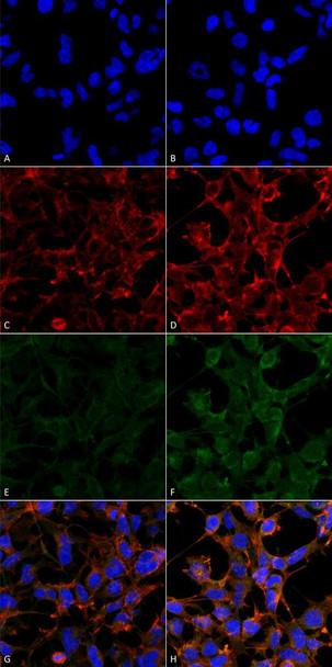 Immunocytochemistry/Immunofluorescence analysis using Mouse Anti-4-Hydroxynonenal Monoclonal Antibody, Clone 12F7 (STMA00182). Tissue: Embryonic kidney epithelial cell line (HEK293). Species: Human. Fixation: 5% Formaldehyde for 5 min. Primary Antibody: Mouse Anti-4-Hydroxynonenal Monoclonal Antibody (STMA00182) at 1:50 for 30-60 min at RT. Secondary Antibody: Goat Anti-Mouse Alexa Fluor 488 at 1:1500 for 30-60 min at RT.