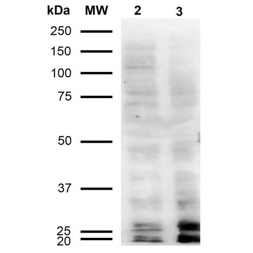 Western Blot analysis of Human Cervical cancer cell line (HeLa) lysate showing detection of Malondialdehyde protein using Mouse Anti-Malondialdehyde Monoclonal Antibody, Clone 11E3 (STMA00185). Lane 1: Molecular Weight Ladder (MW). Lane 2: HeLa cell lysate. Lane 3: H2O2 treated HeLa cell lysate. Load: 12 µg. Block: 5% Skim Milk in TBST. Primary Antibody: Mouse Anti-Malondialdehyde Monoclonal Antibody (STMA00185) at 1:1000 for 2 hours at RT.