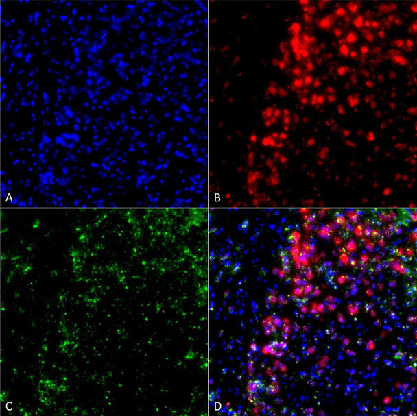 Immunocytochemistry/Immunofluorescence analysis using Mouse Anti-Alpha Synuclein Monoclonal Antibody, Clone 3F8 (STMA00193). Tissue: Primary hippocampal neurons treated with active Alpha Synuclein Protein Aggregate at 4 µg/ml to induce fibrils. Species: Rat. Fixation: 4% paraformaldehyde. Primary Antibody: Mouse Anti-Alpha Synuclein Monoclonal Antibody (STMA00193) at 1:200 for 24 hours at 4°C.
