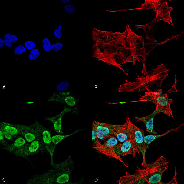 Immunocytochemistry/Immunofluorescence analysis using Mouse Anti-Alpha Synuclein Monoclonal Antibody, Clone 3C11 (STMA00191). Tissue: Neuroblastoma cell line (SK-N-BE). Species: Human. Fixation: 4% Formaldehyde for 15 min at RT. Primary Antibody: Mouse Anti-Alpha Synuclein Monoclonal Antibody (STMA00191) at 1:100 for 60 min at RT. Secondary Antibody: Goat Anti-Mouse ATTO 488 at 1:200 for 60 min at RT.