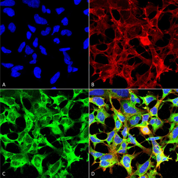 Immunocytochemistry/Immunofluorescence analysis using Mouse Anti-Sulfotyrosine Monoclonal Antibody, Clone 12B11 (STMA00190). Tissue: Embryonic kidney epithelial cell line (HEK293). Species: Human. Fixation: 5% Formaldehyde for 5 min. Primary Antibody: Mouse Anti-Sulfotyrosine Monoclonal Antibody (STMA00190) at 1:50 for 30-60 min at RT. Secondary Antibody: Goat Anti-Mouse Alexa Fluor 488 at 1:1500 for 30-60 min at RT.