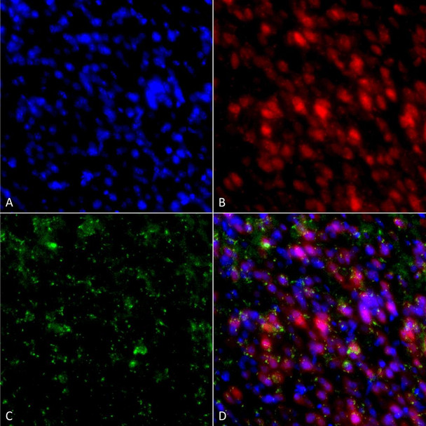 Immunocytochemistry/Immunofluorescence analysis using Mouse Anti-Alpha Synuclein Monoclonal Antibody, Clone 4F1 (STMA00194). Tissue: Primary hippocampal neurons treated with active Alpha Synuclein Protein Aggregate at 4 µg/ml to induce fibrils. Species: Rat. Fixation: 4% paraformaldehyde. Primary Antibody: Mouse Anti-Alpha Synuclein Monoclonal Antibody (STMA00194) at 1:200 for 24 hours at 4°C.