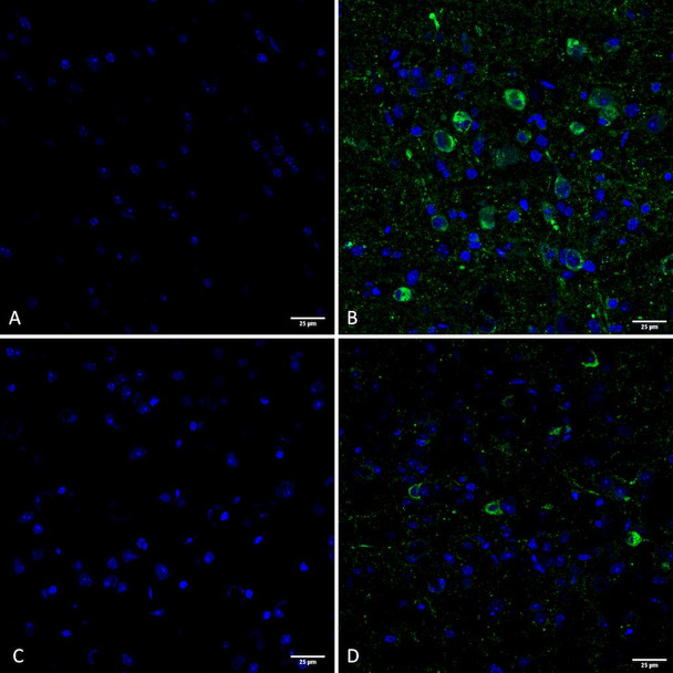 Immunohistochemistry analysis using Rabbit Anti-Tau Monoclonal Antibody, Clone AH36 (STMA00207). Tissue: Brain slice. Species: Mouse. Primary Antibody: Rabbit Anti-Tau Monoclonal Antibody (STMA00207) at 1:500 for Overnight at 4C. Secondary Antibody: Anti-Rabbit IgG: AlexaFluor 488. Counterstain: DAPI at 1:1000 for 5 min. (A) Pons of Non-Tg mouse. (B) Pons of P301SxUBQLN2 Tg mouse. (C) Prefrontal cortex of Non-Tg mouse.