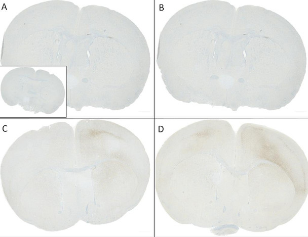 Immunohistochemistry analysis using Rabbit Anti-Alpha Synuclein pSer129 Monoclonal Antibody, Clone J18 (STMA00206). Tissue: Brain. Species: Mouse. Primary Antibody: Rabbit Anti-Alpha Synuclein pSer129 Monoclonal Antibody (STMA00206) at 1:10000. Secondary Antibody: anti-rabbit HRP. C57/BL6 mice were injected with sonicated recombinant mouse alpha synuclein monomers or fibrils at 8 weeks of age.