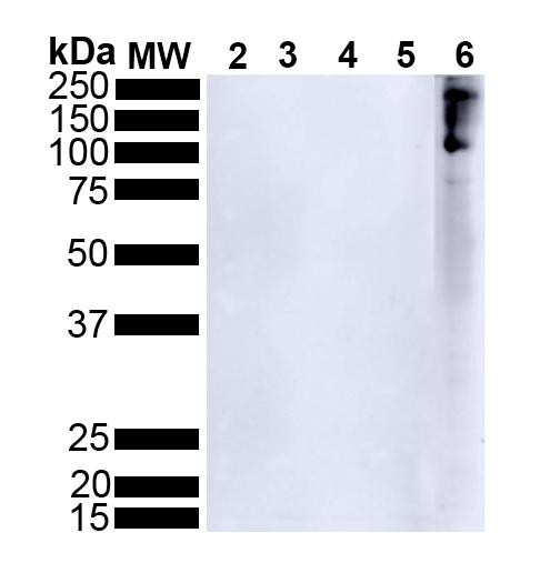 Western Blot analysis of Human Alpha Synuclein showing detection of Alpha Synuclein pSer129 protein using Rabbit Anti-Alpha Synuclein pSer129 Monoclonal Antibody, Clone J18 (STMA00206). Lane 1: MW ladder. Lane 2: 0.5 ug human alpha synuclein monomer. Lane 3: 2 ug human alpha synuclein monomer. Lane 4: 0.5 ug human alpha synuclein PFFs. Lane 5: 2 ug human alpha synuclein PFFs. Lane 6: 15 ug human Parkinson's Disease brain lysate.