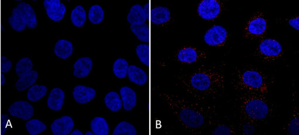 Immunocytochemistry/Immunofluorescence analysis using Mouse Anti-VPS35 Monoclonal Antibody, Clone 7E4 (STMA00208). Tissue: A549 cells. Species: Human. Primary Antibody: Mouse Anti-VPS35 Monoclonal Antibody (STMA00208) at 1:5 (tissue culture supernatant). Secondary Antibody: Donkey anti-mouse: Alexa Fluor 594 at 1:4000 in 0.2% BSA PBS. Counterstain: DAPI. Localization: Vesicles. A) VPS35 KO A549 cells B) WT A549 cells.
