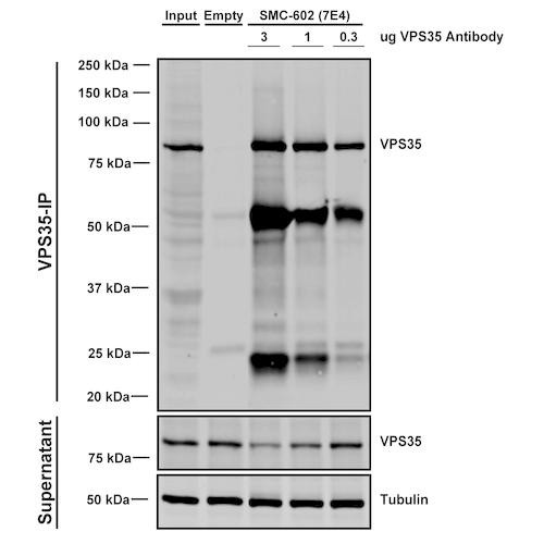 Immunoprecipitation analysis using Mouse Anti-VPS35 Monoclonal Antibody, Clone 7E4 (STMA00208). Tissue: A549 cells. Species: Human. Primary Antibody: Mouse Anti-VPS35 Monoclonal Antibody (STMA00208). Three amounts of STMA00208 (3, 1 and 0.3 ug) were non-covalently coupled to 10uL of A/G sepharose beads for 1 hour at 4°C and next incubated with 250ug of A549 lysate for 2 hours at 4°C.