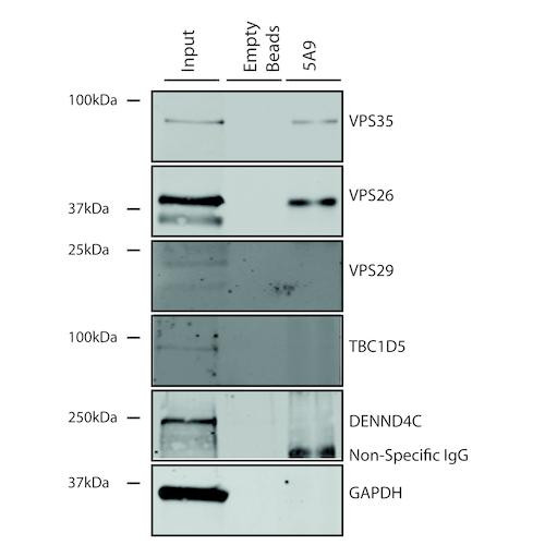 Immunoprecipitation analysis using Mouse Anti-VPS35 Monoclonal Antibody, Clone 5A9 (STMA00209). Tissue: A549 cells. Species: Human. Primary Antibody: Mouse Anti-VPS35 Monoclonal Antibody (STMA00209).