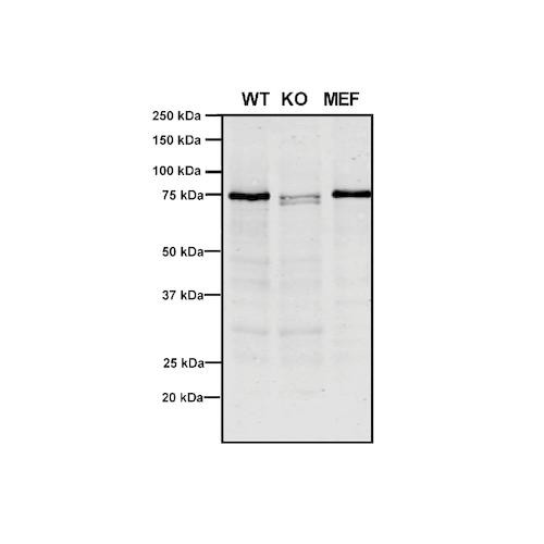 Western Blot analysis of Human, Mouse A549, MEF showing detection of VPS35 protein using Mouse Anti-VPS35 Monoclonal Antibody, Clone 10A8 (STMA00211). Lane 1: Molecular Weight Ladder. Lane 2: VPS35 KO A549 cells. Lane 3: mouse embryonic fibroblast cells. Load: 8 µg each A549 and MEF. Primary Antibody: Mouse Anti-VPS35 Monoclonal Antibody (STMA00211) at 1:5 (tissue culture supernatant).