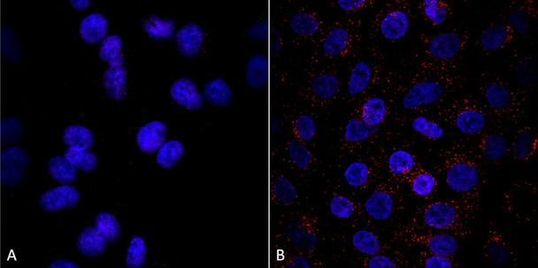 Immunocytochemistry/Immunofluorescence analysis using Mouse Anti-VPS35 Monoclonal Antibody, Clone 8A3 (STMA00210). Tissue: A549 cells. Species: Human. Primary Antibody: Mouse Anti-VPS35 Monoclonal Antibody (STMA00210) at 1:5 (tissue culture supernatant). Secondary Antibody: Donkey anti-mouse: Alexa Fluor 594 at 1:4000 in 0.2% BSA PBS. Counterstain: DAPI. Localization: Vesicles. A) VPS35 KO A549 cells B) WT A549 cells.