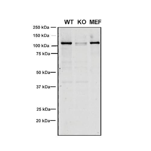 Western Blot analysis of Human, Mouse A549, MEF showing detection of VPS35 protein using Mouse Anti-VPS35 Monoclonal Antibody, Clone 8A3 (STMA00210). Lane 1: Molecular Weight Ladder. Lane 2: VPS35 KO A549 cells. Lane 3: mouse embryonic fibroblast cells. Load: 8 µg each A549 and MEF. Primary Antibody: Mouse Anti-VPS35 Monoclonal Antibody (STMA00210) at 1:5 (tissue culture supernatant).