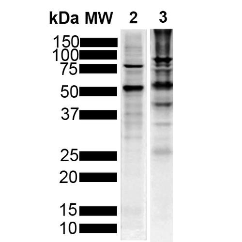 Western Blot analysis of Human, Mouse Breast Cancer Cell line, Brain showing detection of Tau protein using Mouse Anti-Tau Monoclonal Antibody, Clone 1D5 (STMA00213). Lane 1: MW Marker. Lane 2: Human T-47d (10ug). Lane 3: Mouse Brain (20ug). Block: 5% Skim Milk powder in TBST. Primary Antibody: Mouse Anti-Tau Monoclonal Antibody (STMA00213) at 1:1000 for 2 hours at RT with shaking.