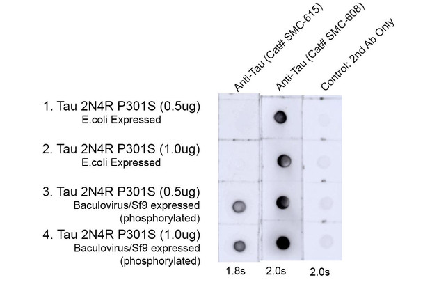 Dot Blot analysis of Human, Mouse, Rat Tau 2N4R P301S (phospho & non-phospho) showing detection of Tau protein using Mouse Anti-Tau Monoclonal Antibody, Clone 15B7 (STMA00220). Lane 1: hTau 2N4R P301S Monomer(0.5ug). Lane 2: hTau 2N4R P301S Monomer(1.0ug). Lane 3: Recombinant hTau-441 (2N4R) P301S Monomer, Baculovirus/Sf9 Expressed (phosphorylated)(0.5ug).