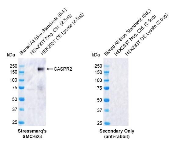 Western blot analysis with Rabbit Anti-CASPR2 Monoclonal Antibody, Clone FF19 (STMA00227) showing detection of Human CASPR2 protein in a transient over-expression (OE) lysate (OriGene LY402278). Block: 2% skim milk + 2% BSA for 1 hour at RT. Primary Antibody: Rabbit Anti-Human CASPR2 Recombinant Monoclonal [FF19] (STMA00227) at 1:1000 for 2 hours at RT. Secondary Antibody: Goat anti-rabbit IgG-HRP (H&L) at 1:5000 for 1 hour at RT.