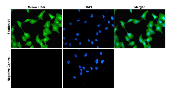 Immunocytochemistry/Immunofluorescence analysis with Rabbit Anti-CASPR2 Monoclonal Antibody, Clone FF19 (STMA00227). Tissue: Neuroblastoma cells (Kelly). Species: Human. Fixation: 4% PFA for 10 min at RT. Permeabilization: 0.15% TritonX for 15 min at RT. Blocking: 10% goat serum for 40 min at RT. Primary Antibody: Rabbit Anti-Human CASPR2 Recombinant Monoclonal [FF19] (STMA00227) at 1:100 for 1 hour at RT.