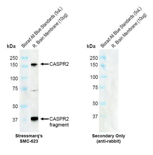 Western blot analysis with Rabbit Anti-CASPR2 Monoclonal Antibody, Clone FF19 (STMA00227) showing detection of Human CASPR2 protein in a Rat brain membrane lysate. Block: 2% skim milk + 2% BSA for 1 hour at RT. Primary Antibody: Rabbit Anti-Human CASPR2 Recombinant Monoclonal [FF19] (STMA00227) at 1:1000 for 2 hours at RT. Secondary Antibody: Goat anti-rabbit IgG-HRP (H&L) at 1:5000 for 1 hour at RT.