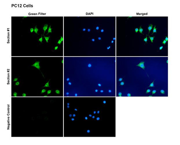 Immunocytochemistry/Immunofluorescence analysis with Rabbit Anti-Kv1.3 Monoclonal Antibody, Clone CAR1.1 (STMA00234). Tissue: Pheochromocytoma cells (PC-12). Species: Rat. Fixation: 4% PFA for 10 min at RT. Permeabilization: 0.15% TritonX for 15 min at RT. Blocking: 10% goat serum for 40 min at RT. Primary Antibody: Rabbit Anti-Rat Kv1.3 Recombinant Monoclonal [CAR1.1] (STMA00234) at 1:100 for 1 hour at RT.