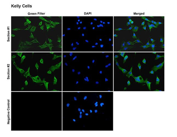 Immunocytochemistry/Immunofluorescence analysis with Rabbit Anti-Kv1.2 Monoclonal Antibody, Clone C25 (STMA00232). Tissue: Neuroblastoma cells (Kelly). Species: Human. Fixation: 4% PFA for 10 min at RT. Permeabilization: 0.15% TritonX for 15 min at RT. Blocking: 10% goat serum for 40 min at RT. Primary Antibody: Rabbit Anti-Human Kv1.2 Recombinant Monoclonal [C25] (STMA00232) at 1:100 for 1 hour at RT.
