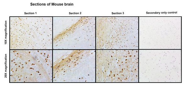Immunohistochemistry analysis with Rabbit Anti- Slo1 Monoclonal Antibody, Clone S22 (STMA00229). Tissue: Brain. Species: Mouse. Fixation: Paraffin embedded, 4um thin. Blocking: 3% milk for 1 hour at RT. Primary Antibody: Rabbit Anti-Mouse Slo1 Recombinant Monoclonal [S22] (STMA00229) at 1:100 for 1 hour at RT. Secondary Antibody: Goat anti-rabbit IgG:HRP(H&L) at 1:100 for 45 min at RT.