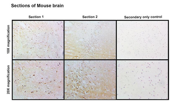 Immunohistochemistry analysis with Rabbit Anti-CASK Monoclonal Antibody, Clone PT55 (STMA00230). Tissue: Brain. Species: Mouse. Fixation: Paraffin embedded, 4um thin. Blocking: 3% milk for 1 hour at RT. Primary Antibody: Rabbit Anti-Human CASK Recombinant Monoclonal [PT55] (STMA00230) at 1:100 for 1 hour at RT. Secondary Antibody: Goat anti-rabbit IgG-HRP (H&L) at 1:100 for 45 min at RT.