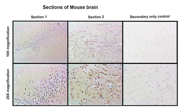 Immunohistochemistry analysis with Rabbit Anti-PSD95 Monoclonal Antibody, Clone B14 (STMA00228). Tissue: Brain. Species: Mouse. Fixation: Paraffin embedded, 4um thin. Blocking: 3% milk for 1 hour at RT. Primary Antibody: Rabbit Anti-Human PSD95 Recombinant Monoclonal [B14] (STMA00228) at 1:100 for 1 hour at RT. Secondary Antibody: Goat anti-rabbit IgG-HRP (H&L) at 1:100 for 45 min at RT.