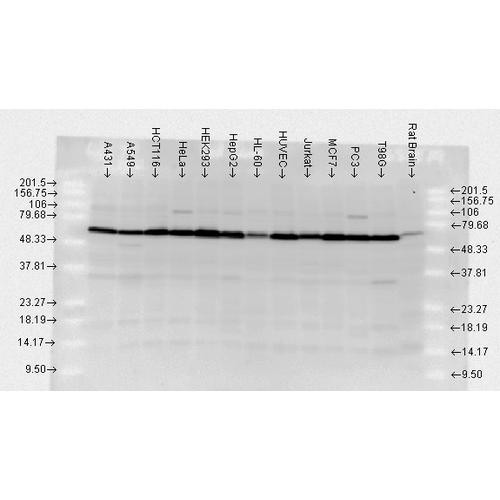 Western blot analysis of Human, Rat brain cell lysates showing detection of HSP70 protein using Rabbit Anti-HSP70 Polyclonal Antibody (STPA00002). Load: 2 µg. Block: 1.5% BSA for 30 minutes at RT. Primary Antibody: Rabbit Anti-HSP70 Polyclonal Antibody (STPA00002) at 1:10000 for 2 hours at RT. Secondary Antibody: Donkey Anti-Rabbit IgG: HRP for 1 hour at RT.