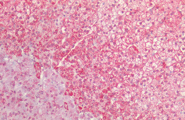 Immunohistochemistry analysis using Rabbit Anti-HSP60 Polyclonal Antibody (STPA00004). Tissue: Adrenal. Species: Human. Fixation: Formalin fixed paraffin-embedded. Primary Antibody: Rabbit Anti-HSP60 Polyclonal Antibody (STPA00004).