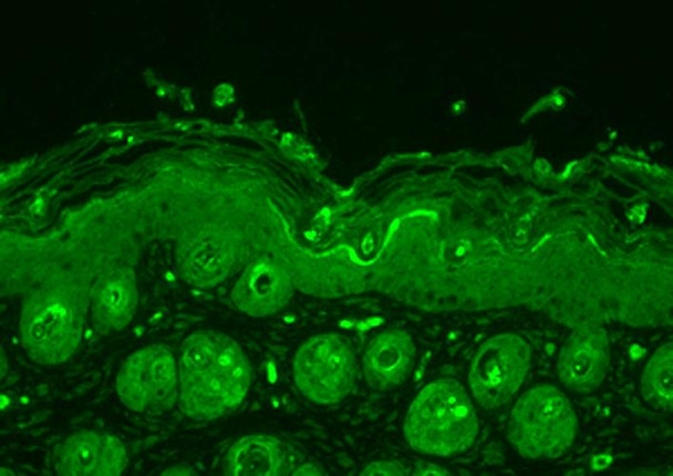 Immunohistochemistry analysis using Rabbit Anti-Ubiquitin Polyclonal Antibody (STPA00015). Tissue: backskin. Species: Mouse. Fixation: Bouin's Fixative Solution. Primary Antibody: Rabbit Anti-Ubiquitin Polyclonal Antibody (STPA00015) at 1:100 for 1 hour at RT. Secondary Antibody: FITC Goat Anti-Rabbit (green) at 1:50 for 1 hour at RT. Localization: Cytoplasm.