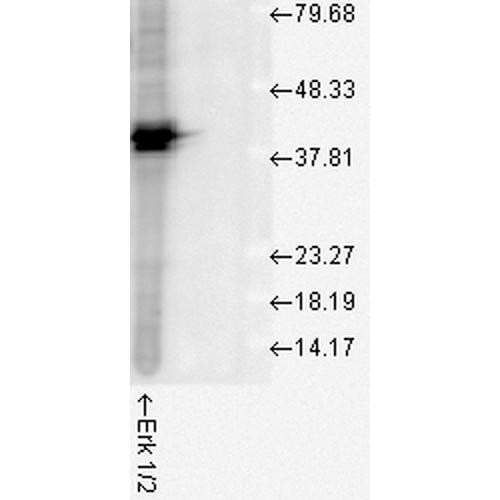 Western blot analysis of Human Cell line lysates showing detection of ERK1 protein using Rabbit Anti-ERK1 Polyclonal Antibody (STPA00016). Load: 15 µgprotein. Block: 1.5% BSA for 30 minutes at RT. Primary Antibody: Rabbit Anti-ERK1 Polyclonal Antibody (STPA00016) at 1:1000 for 2 hours at RT. Secondary Antibody: Donkey Anti-Rabbit IgG: HRP for 1 hour at RT.