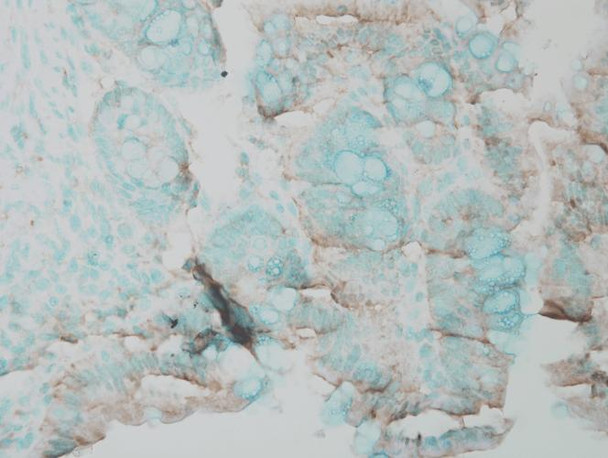 Immunohistochemistry analysis using Rabbit Anti-ERK1 Polyclonal Antibody (STPA00016). Tissue: Inflamed colon. Species: Mouse. Fixation: Formalin. Primary Antibody: Rabbit Anti-ERK1 Polyclonal Antibody (STPA00016) at 1:25000 for 12 hours at 4°C. Secondary Antibody: Biotin Goat Anti-Rabbit at 1:2000 for 1 hour at RT. Counterstain: Methyl Green at 200uL for 2 min at RT. This image was produced using an amplifying IHC wash buffer.