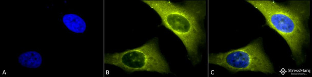 Immunocytochemistry/Immunofluorescence analysis using Rabbit Anti-Rab4 Polyclonal Antibody (STPA00019). Tissue: Heat Shocked Cervical cancer cell line (HeLa). Species: Human. Fixation: 2% Formaldehyde for 20 min at RT. Primary Antibody: Rabbit Anti-Rab4 Polyclonal Antibody (STPA00019) at 1:150 for 12 hours at 4°C. Secondary Antibody: R-PE Goat Anti-Rabbit (yellow) at 1:200 for 2 hours at RT.