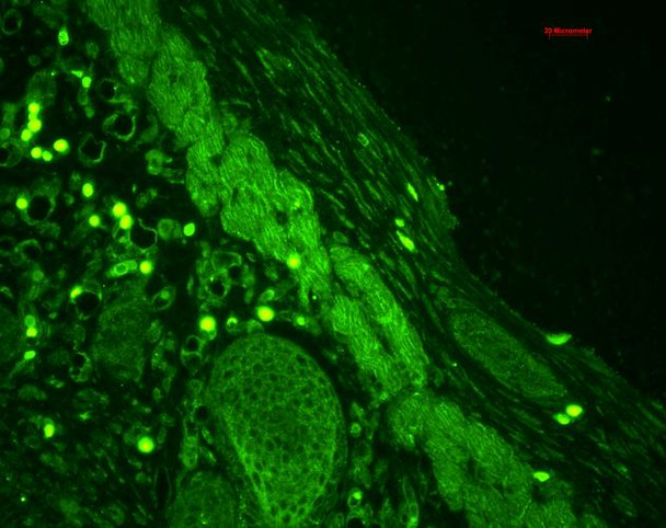 Immunohistochemistry analysis using Rabbit Anti-Rab4 Polyclonal Antibody (STPA00019). Tissue: backskin. Species: Mouse. Fixation: Bouin's Fixative Solution. Primary Antibody: Rabbit Anti-Rab4 Polyclonal Antibody (STPA00019) at 1:100 for 1 hour at RT. Secondary Antibody: FITC Goat Anti-Rabbit (green) at 1:50 for 1 hour at RT. Localization: Epidermis (cell-cell border and cytoplasmic), hair follicles and muscle.