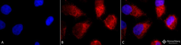 Immunocytochemistry/Immunofluorescence analysis using Rabbit Anti-TNF-R1 Polyclonal Antibody (STPA00026). Tissue: Cervical cancer cell line (HeLa). Species: Human. Fixation: 2% Formaldehyde for 20 min at RT. Primary Antibody: Rabbit Anti-TNF-R1 Polyclonal Antibody (STPA00026) at 1:100 for 12 hours at 4°C. Secondary Antibody: APC Goat Anti-Rabbit (red) at 1:200 for 2 hours at RT.
