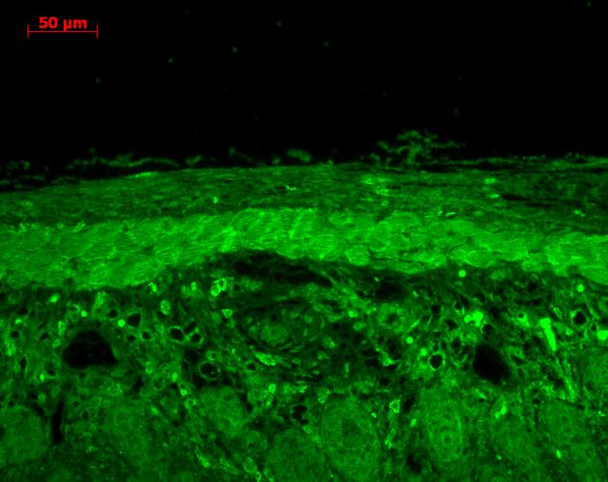 Immunohistochemistry analysis using Rabbit Anti-HSP22 Polyclonal Antibody (STPA00030). Tissue: backskin. Species: Mouse. Fixation: Bouin's Fixative Solution. Primary Antibody: Rabbit Anti-HSP22 Polyclonal Antibody (STPA00030) at 1:100 for 1 hour at RT. Secondary Antibody: FITC Goat Anti-Rabbit (green) at 1:50 for 1 hour at RT. Localization: Epidermis positive, dermal staining.
