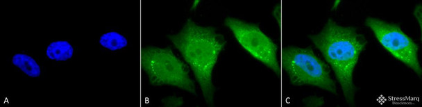 Immunocytochemistry/Immunofluorescence analysis using Rabbit Anti-Calnexin-CT Polyclonal Antibody (STPA00031). Tissue: Heat Shocked Cervical cancer cell line (HeLa). Species: Human. Fixation: 2% Formaldehyde for 20 min at RT. Primary Antibody: Rabbit Anti-Calnexin-CT Polyclonal Antibody (STPA00031) at 1:80 for 12 hours at 4°C. Secondary Antibody: FITC Goat Anti-Rabbit (green) at 1:200 for 2 hours at RT.