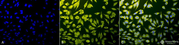 Immunocytochemistry/Immunofluorescence analysis using Rabbit Anti-Calnexin-CT Polyclonal Antibody (STPA00031). Tissue: Heat Shocked Cervical cancer cell line (HeLa). Species: Human. Fixation: 2% Formaldehyde for 20 min at RT. Primary Antibody: Rabbit Anti-Calnexin-CT Polyclonal Antibody (STPA00031) at 1:80 for 12 hours at 4°C. Secondary Antibody: R-PE Goat Anti-Rabbit (yellow) at 1:200 for 2 hours at RT.