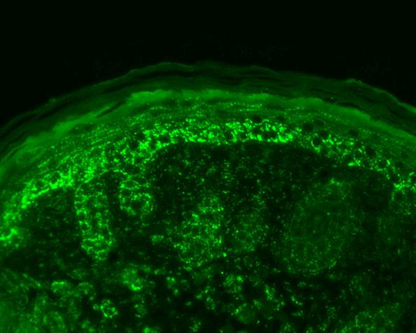Immunohistochemistry analysis using Rabbit Anti-Cpn10 Polyclonal Antibody (STPA00036). Tissue: backskin. Species: Mouse. Fixation: Bouin's Fixative Solution. Primary Antibody: Rabbit Anti-Cpn10 Polyclonal Antibody (STPA00036) at 1:100 for 1 hour at RT. Secondary Antibody: FITC Goat Anti-Rabbit (green) at 1:50 for 1 hour at RT. Localization: Strong basal layer punctate staining in the cytoplasm, weakens as it ascends to upper epidermis.