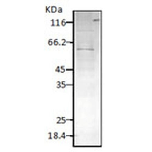 Western blot analysis of Parasite Lysates showing detection of HSP60 protein using Rabbit Anti-HSP60 Polyclonal Antibody (STPA00033). Primary Antibody: Rabbit Anti-HSP60 Polyclonal Antibody (STPA00033) at 1:1000.