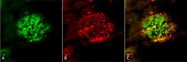 Immunohistochemistry analysis using Rabbit Anti-Amyloid Fibrils (OC) Polyclonal Antibody (STPA00056). Tissue: Alzheimer's Disease brain. Species: Human. Fixation: Formalin fixed. Primary Antibody: Rabbit Anti-Amyloid Fibrils (OC) Polyclonal Antibody (STPA00056) at 1:5000. Secondary Antibody: Goat Anti-Rabbit ATTO 488 (green). Localization: Plaque. (A) Amyloid Fibril (OC) Antibody (STPA00056). (B) Amyloid Oligomer (A11) Antibody (STPA00055).