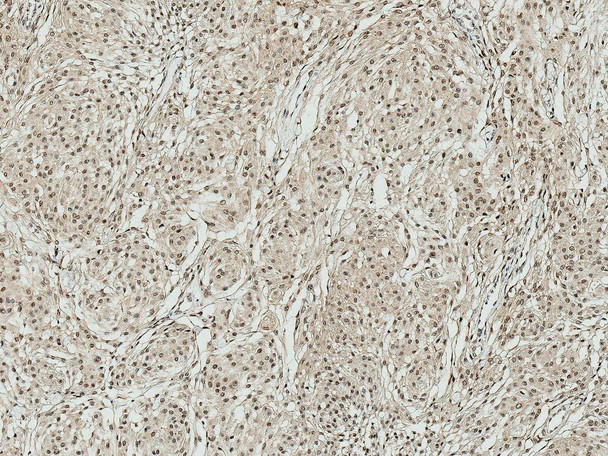 Immunohistochemistry analysis using Rabbit Anti-ATG10 Polyclonal Antibody (STPA00060). Tissue: Brain. Species: Human. Fixation: Formalin Fixed Paraffin-Embedded. Primary Antibody: Rabbit Anti-ATG10 Polyclonal Antibody (STPA00060) at 1:50 for 31 min at RT. Counterstain: Hematoxylin. Magnification: 10X.