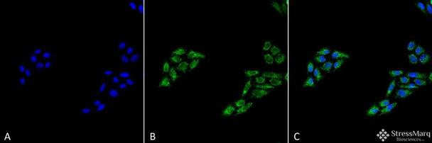 Immunocytochemistry/Immunofluorescence analysis using Rabbit Anti-p53 Polyclonal Antibody (STPA00069). Tissue: Cervical cancer cell line (HeLa). Species: Human. Fixation: 4% Formaldehyde for 15 min at RT. Primary Antibody: Rabbit Anti-p53 Polyclonal Antibody (STPA00069) at 1:100 for 60 min at RT. Secondary Antibody: Goat Anti-Rabbit ATTO 488 at 1:100 for 60 min at RT. Counterstain: DAPI (blue) nuclear stain at 1:5000 for 5 min RT.