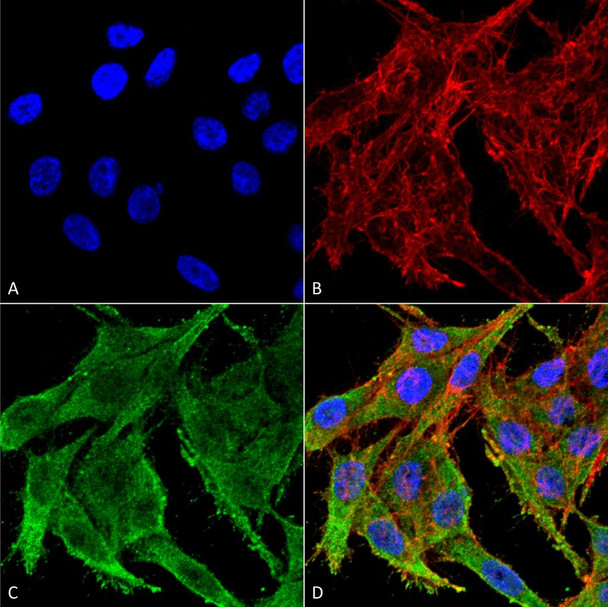 Immunocytochemistry/Immunofluorescence analysis using Rabbit Anti-Kir4.1 Polyclonal Antibody (STPA00071). Tissue: Colon carcinoma cell line (RKO). Species: Human. Fixation: 4% Formaldehyde for 15 min at RT. Primary Antibody: Rabbit Anti-Kir4.1 Polyclonal Antibody (STPA00071) at 1:100 for 60 min at RT. Secondary Antibody: Goat Anti-Rabbit ATTO 488 at 1:100 for 60 min at RT.