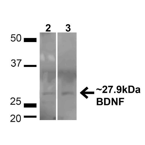 Western blot analysis of Human HeLa and HEK293T cell lysates showing detection of ~27.9 Kda BDNF protein using Rabbit Anti-BDNF Polyclonal Antibody (STPA00072). Lane 1: MW Ladder. Lane 2: Human HeLa (20 µg). Lane 3: Human 293T (20 µg). Load: 20 µg. Block: 5% milk + TBST for 1 hour at RT. Primary Antibody: Rabbit Anti-BDNF Polyclonal Antibody (STPA00072) at 1:1000 for 1 hour at RT.
