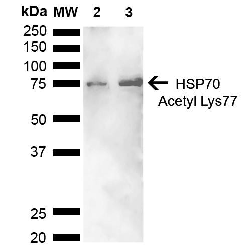 Western blot analysis of Human Cervical cancer cell line (HeLa) lysate showing detection of ~70 kDa HSP70 Acetyl Lys77 protein using Rabbit Anti-HSP70 Acetyl Lys77 Polyclonal Antibody (STPA00079). Lane 1: Molecular Weight Ladder (MW). Lane 2: Cervical Cancer cell line (HeLa) lysate. Lane 3: H2O2 Cervical Cancer cell line (HeLa) lysate. Load: 10 µg. Block: 5% Skim Milk in 1X TBST.