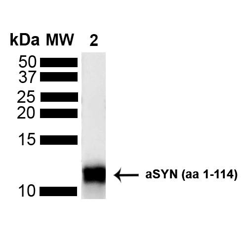 Western blot analysis of Human Truncated Alpha Synuclein Protein showing detection of Alpha Synuclein protein using Rabbit Anti-Alpha Synuclein Polyclonal Antibody (STPA00086). Lane 1: MW Ladder. Lane 2: hASYN aa 1-114 (5 uL). Load: 5 uL. Block: 5% Skim Milk Powder in TBST. Primary Antibody: Rabbit Anti-Alpha Synuclein Polyclonal Antibody (STPA00086) at 1:1000 for 2 hours at RT with shaking.